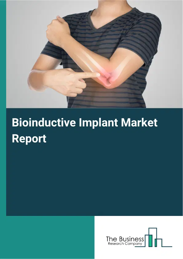 Bioinductive Implant Market Report 2026
